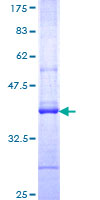 FBXL5 / FBL5 Protein - 12.5% SDS-PAGE Stained with Coomassie Blue.
