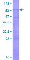 FBXL6 Protein - 12.5% SDS-PAGE of human FBXL6 stained with Coomassie Blue