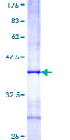 FBXO10 Protein - 12.5% SDS-PAGE Stained with Coomassie Blue.