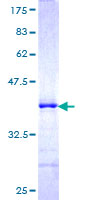 FBXO11 Protein - 12.5% SDS-PAGE Stained with Coomassie Blue.