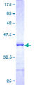 FBXO11 Protein - 12.5% SDS-PAGE Stained with Coomassie Blue.