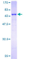 FBXO2 Protein - 12.5% SDS-PAGE of human FBXO2 stained with Coomassie Blue
