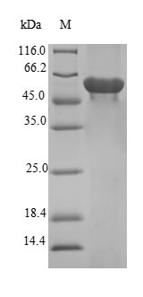 FBXO2 Protein - (Tris-Glycine gel) Discontinuous SDS-PAGE (reduced) with 5% enrichment gel and 15% separation gel.