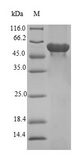 FBXO2 Protein - (Tris-Glycine gel) Discontinuous SDS-PAGE (reduced) with 5% enrichment gel and 15% separation gel.