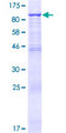 FBXO21 Protein - 12.5% SDS-PAGE of human FBXO21 stained with Coomassie Blue