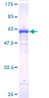FBXO22 Protein - 12.5% SDS-PAGE of human FBXO22 stained with Coomassie Blue