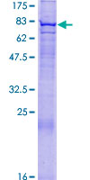 FBXO24 Protein - 12.5% SDS-PAGE of human FBXO24 stained with Coomassie Blue