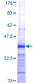 FBXO24 Protein - 12.5% SDS-PAGE Stained with Coomassie Blue.