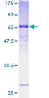 FBXO25 Protein - 12.5% SDS-PAGE of human FBXO25 stained with Coomassie Blue