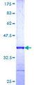 FBXO27 Protein - 12.5% SDS-PAGE Stained with Coomassie Blue.