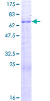 FBXO28 Protein - 12.5% SDS-PAGE of human FBXO28 stained with Coomassie Blue