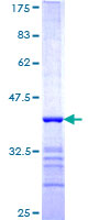 FBXO28 Protein - 12.5% SDS-PAGE Stained with Coomassie Blue.