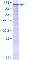 FBXO30 Protein - 12.5% SDS-PAGE of human FBXO30 stained with Coomassie Blue