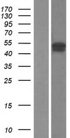 FBXO31 Protein - Western validation with an anti-DDK antibody * L: Control HEK293 lysate R: Over-expression lysate