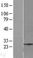 FBXO32 / Fbx32 Protein - Western validation with an anti-DDK antibody * L: Control HEK293 lysate R: Over-expression lysate