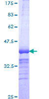 FBXO34 Protein - 12.5% SDS-PAGE Stained with Coomassie Blue.