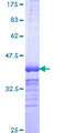 FBXO34 Protein - 12.5% SDS-PAGE Stained with Coomassie Blue.