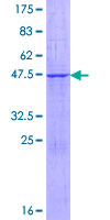 FBXO36 / F-Box Protein 36 Protein - 12.5% SDS-PAGE of human FBXO36 stained with Coomassie Blue