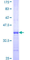 FBXO36 / F-Box Protein 36 Protein - 12.5% SDS-PAGE Stained with Coomassie Blue.