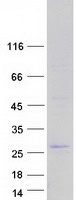 FBXO36 / F-Box Protein 36 Protein - Purified recombinant protein FBXO36 was analyzed by SDS-PAGE gel and Coomassie Blue Staining