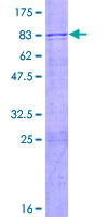 FBXO38 Protein - 12.5% SDS-PAGE of human FBXO38 stained with Coomassie Blue