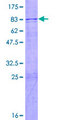 FBXO38 Protein - 12.5% SDS-PAGE of human FBXO38 stained with Coomassie Blue