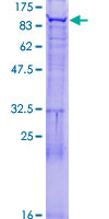 FBXO40 Protein - 12.5% SDS-PAGE of human FBXO40 stained with Coomassie Blue
