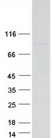 FBXO40 Protein - Purified recombinant protein FBXO40 was analyzed by SDS-PAGE gel and Coomassie Blue Staining