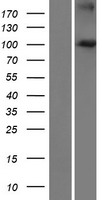 FBXO41 Protein - Western validation with an anti-DDK antibody * L: Control HEK293 lysate R: Over-expression lysate