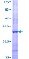 FBXO42 / JFK Protein - 12.5% SDS-PAGE Stained with Coomassie Blue.