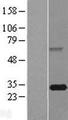 FBXO44 Protein - Western validation with an anti-DDK antibody * L: Control HEK293 lysate R: Over-expression lysate