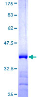FBXO44 Protein - 12.5% SDS-PAGE Stained with Coomassie Blue.