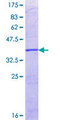 FBXO45 Protein - 12.5% SDS-PAGE Stained with Coomassie Blue.