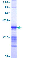 FBXO46 Protein - 12.5% SDS-PAGE Stained with Coomassie Blue.