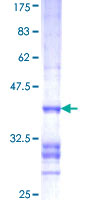 FBXO47 Protein - 12.5% SDS-PAGE Stained with Coomassie Blue.