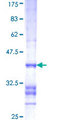 FBXO47 Protein - 12.5% SDS-PAGE Stained with Coomassie Blue.