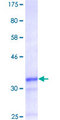 FBXO5 / EMI1 Protein - 12.5% SDS-PAGE Stained with Coomassie Blue.
