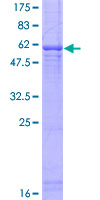 FBXO6 Protein - 12.5% SDS-PAGE of human FBXO6 stained with Coomassie Blue