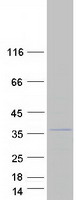 FBXO6 Protein - Purified recombinant protein FBXO6 was analyzed by SDS-PAGE gel and Coomassie Blue Staining