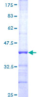 FBXO7 Protein - 12.5% SDS-PAGE Stained with Coomassie Blue.
