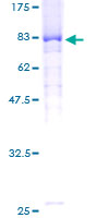 FBXW11 Protein - 12.5% SDS-PAGE of human FBXW11 stained with Coomassie Blue