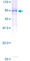 FBXW11 Protein - 12.5% SDS-PAGE of human FBXW11 stained with Coomassie Blue