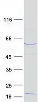 FBXW11 Protein - Purified recombinant protein FBXW11 was analyzed by SDS-PAGE gel and Coomassie Blue Staining