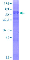 FBXW12 Protein - 12.5% SDS-PAGE of human FBXW12 stained with Coomassie Blue