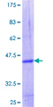 FBXW12 Protein - 12.5% SDS-PAGE Stained with Coomassie Blue.
