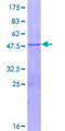FBXW5 Protein - 12.5% SDS-PAGE of human FBXW5 stained with Coomassie Blue