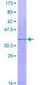 FBXW5 Protein - 12.5% SDS-PAGE Stained with Coomassie Blue.