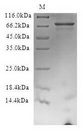 FBXW7 / FBW7 Protein - (Tris-Glycine gel) Discontinuous SDS-PAGE (reduced) with 5% enrichment gel and 15% separation gel.