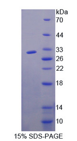 FBXW7 / FBW7 Protein - Recombinant  F-Box And WD Repeat Domain Containing Protein 7 By SDS-PAGE