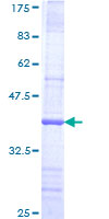 FBXW8 Protein - 12.5% SDS-PAGE Stained with Coomassie Blue.